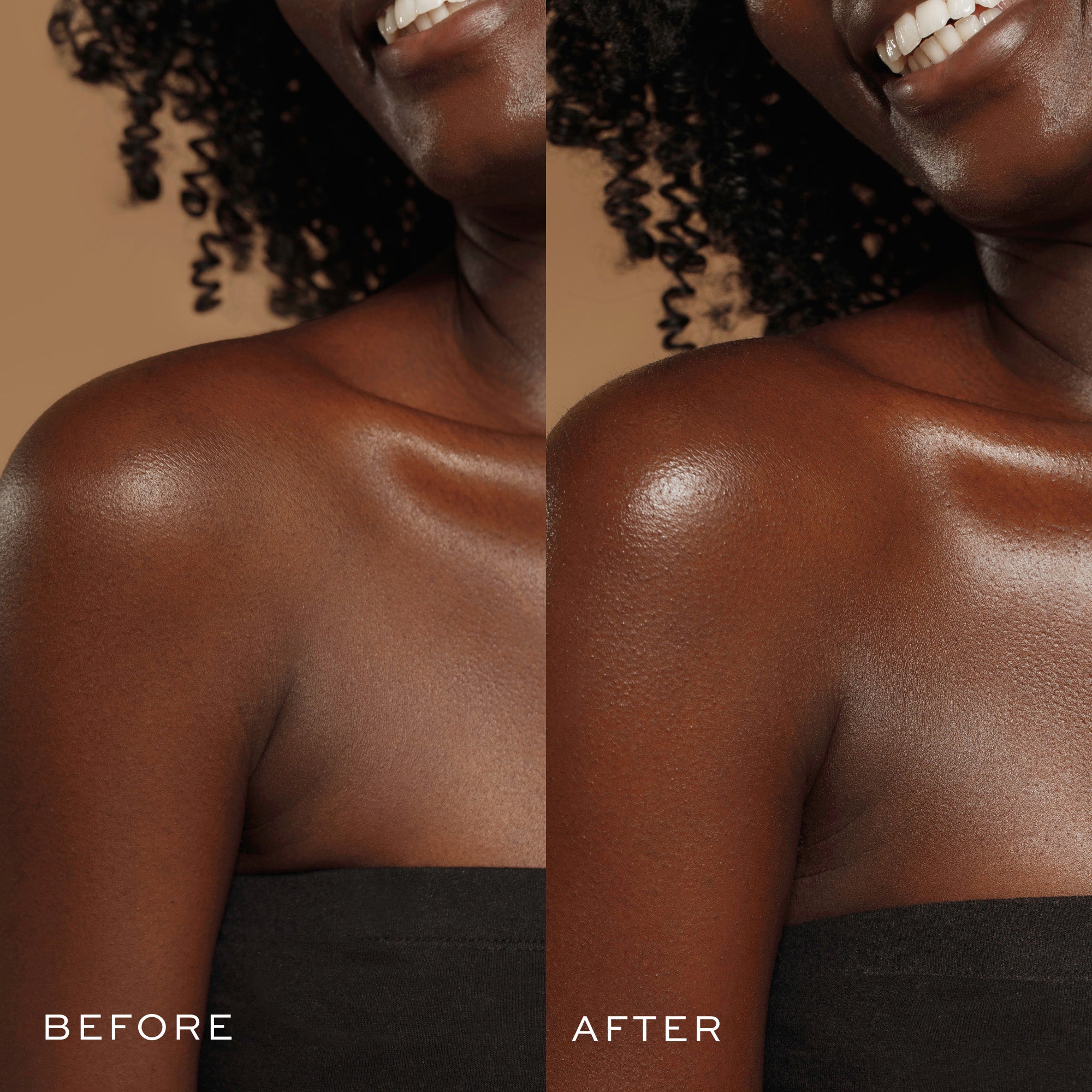 a woman smiling and before and after a tanning procedure