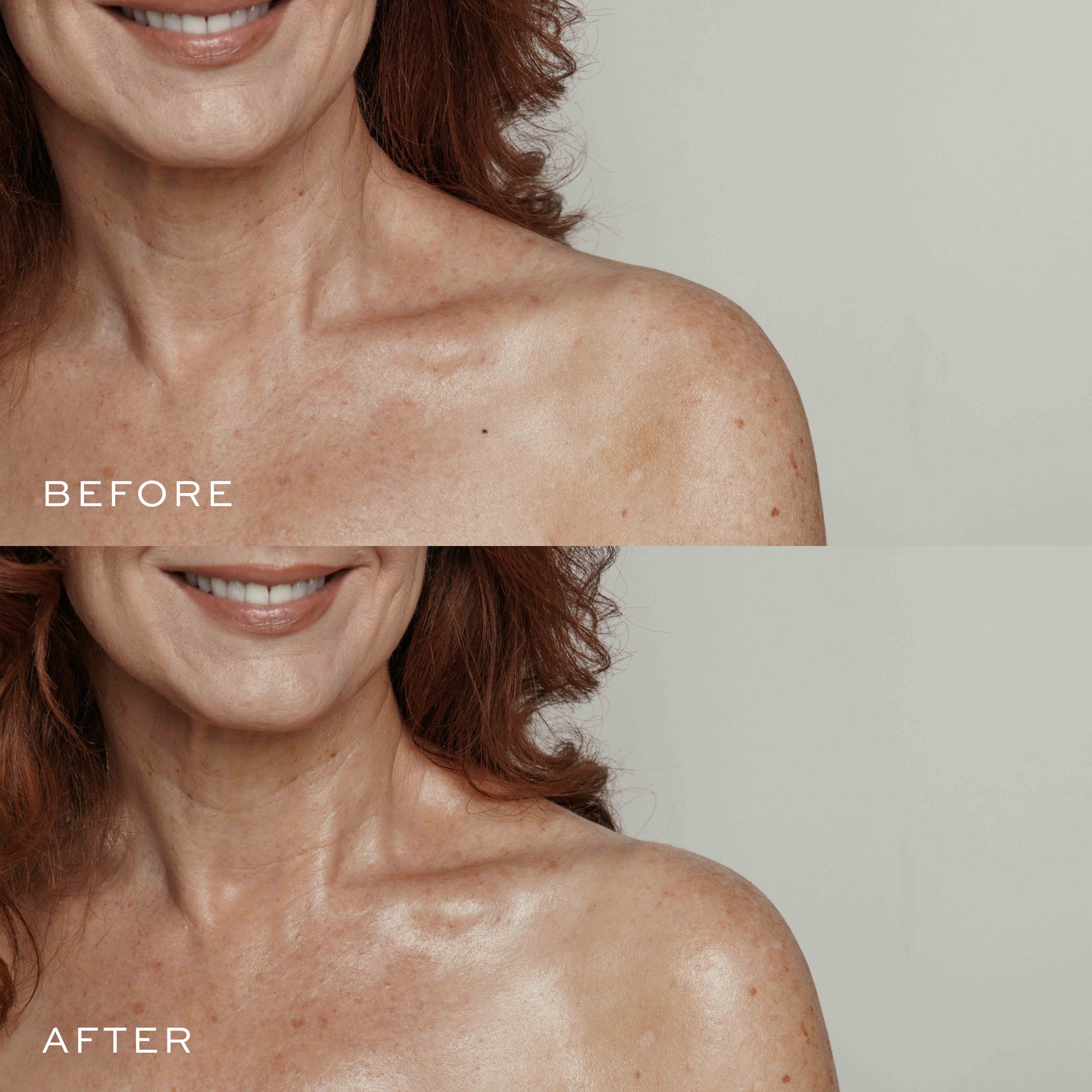 a woman before and after a skincare procedure