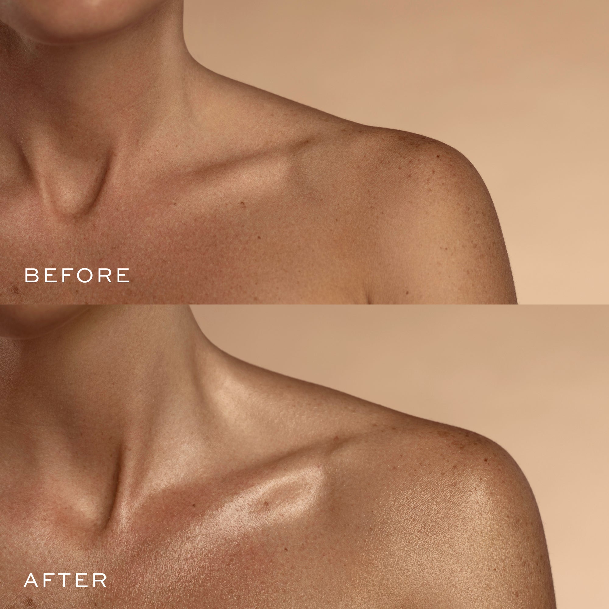 a woman's neck and shoulder before and after