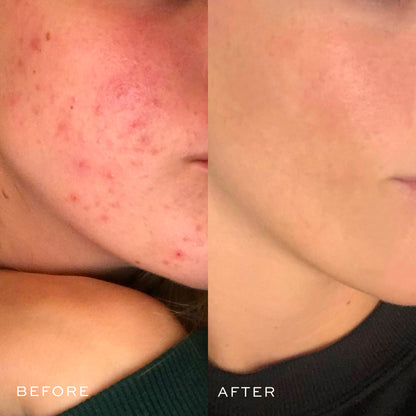 The Complete System Before & After