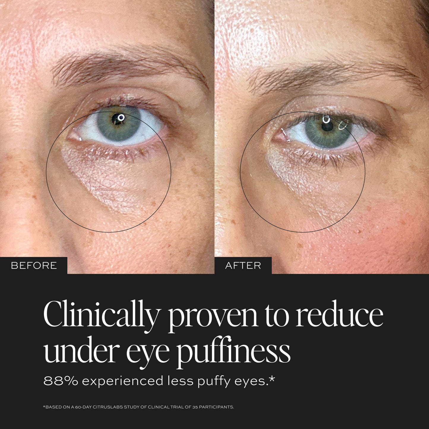 Clinically proven to reduct under eye puffiness