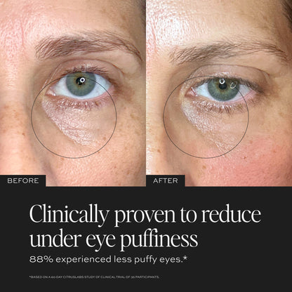 Clinically proven to reduct under eye puffiness