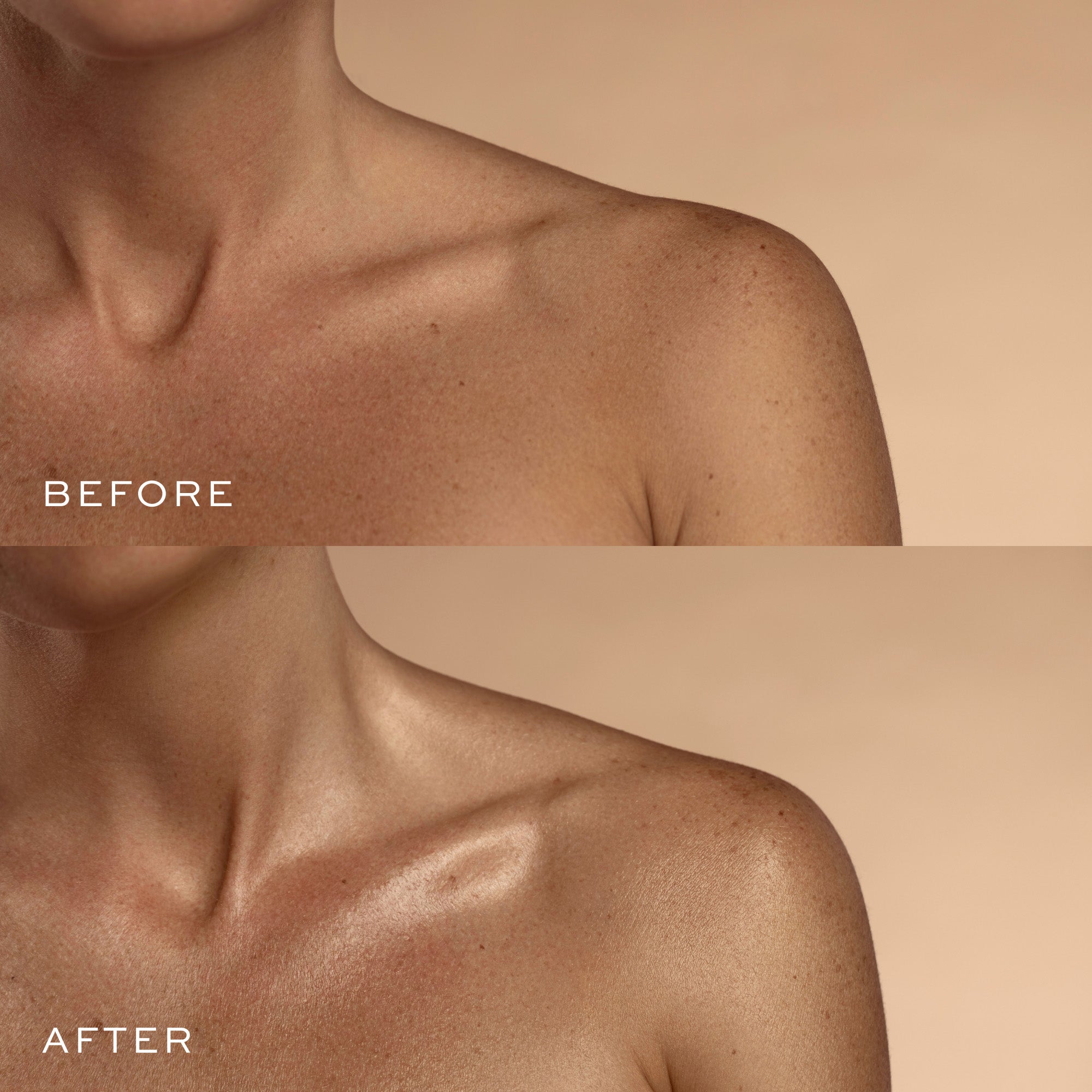 a woman's neck before and after