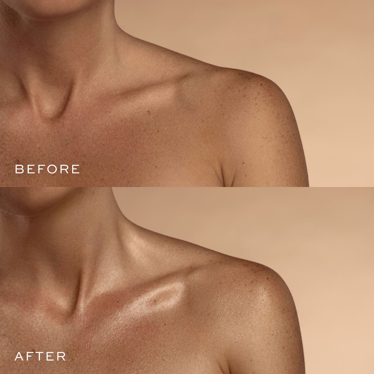 Deluxe Body Set Before & After