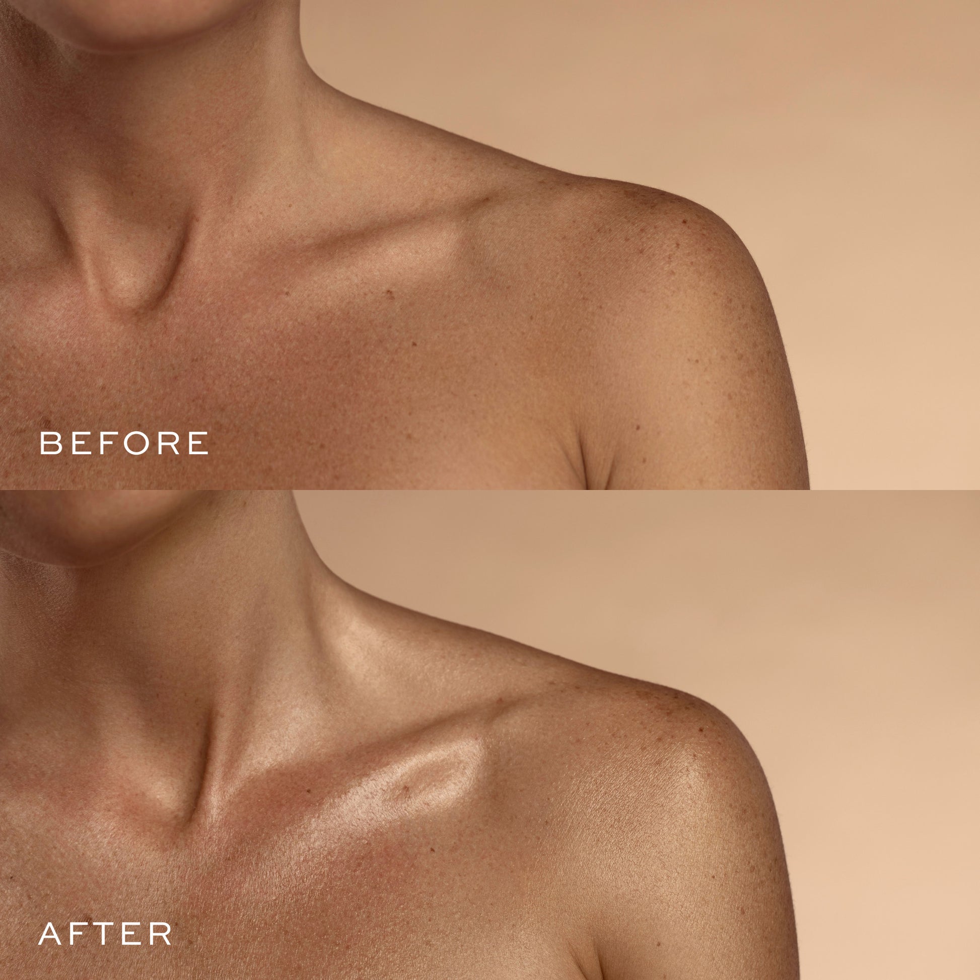 Deluxe Body Set Before & After
