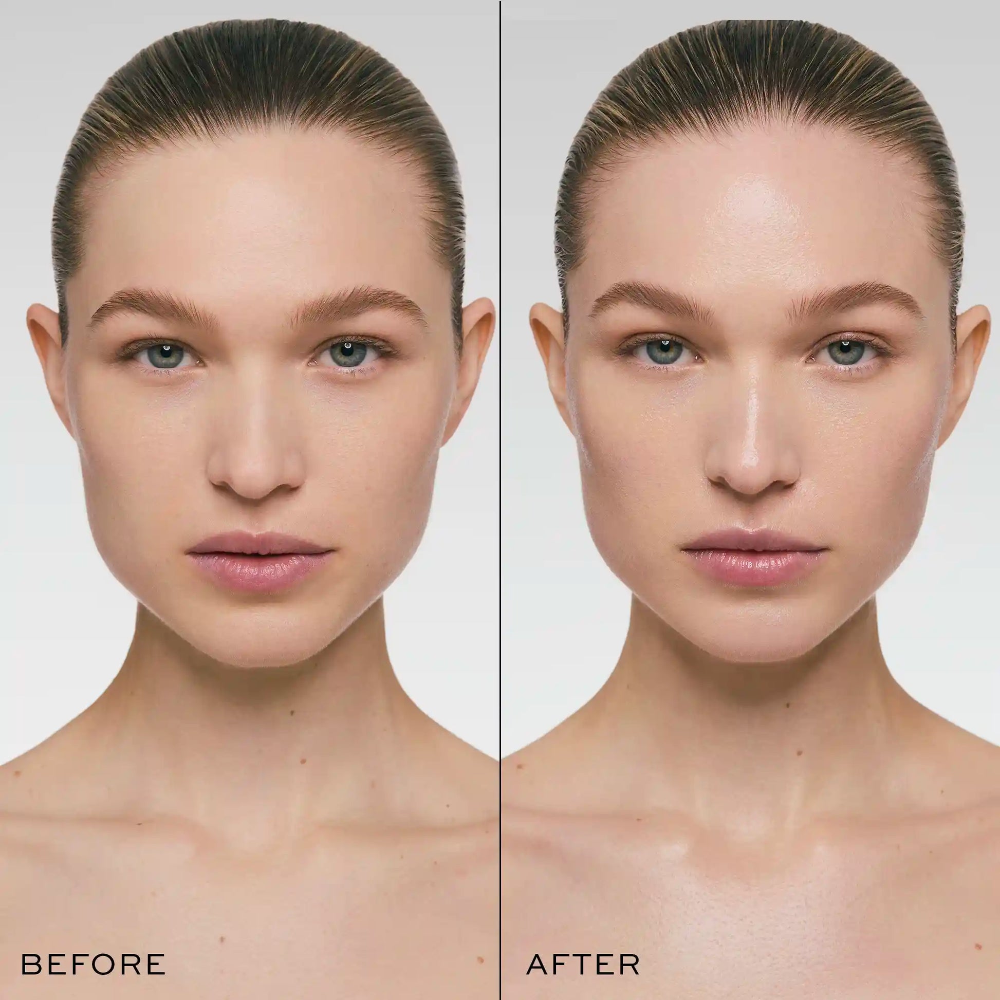 Before and after comparison of a woman's face showing skin texture and appearance changes.