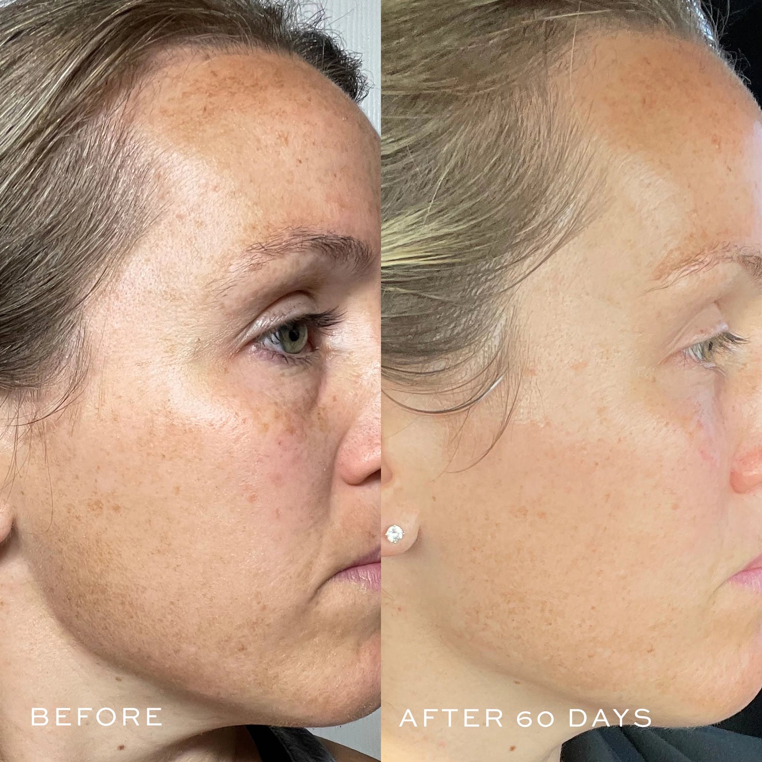 TBT® Serum (Anti-Aging Serum) Before & After