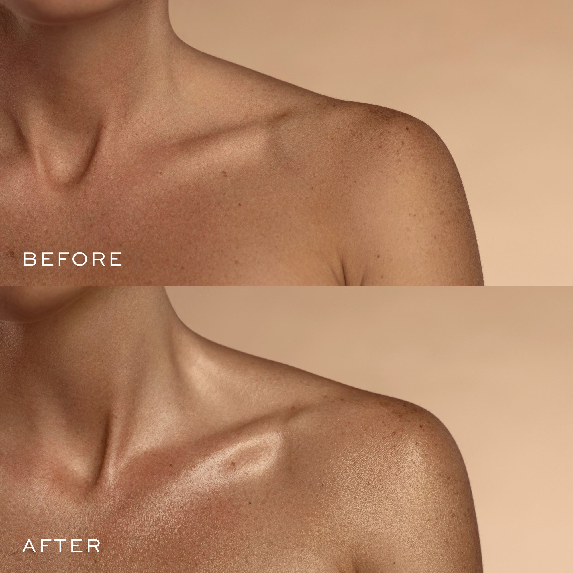 a woman's neck before and after