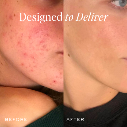 The Works Discovery Set